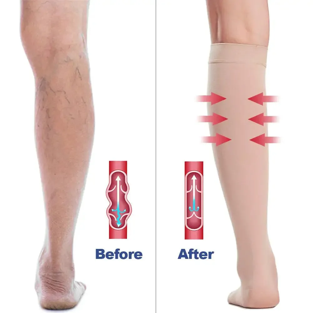 Open Toe Knee High Calf Compression Socks (U CARE)